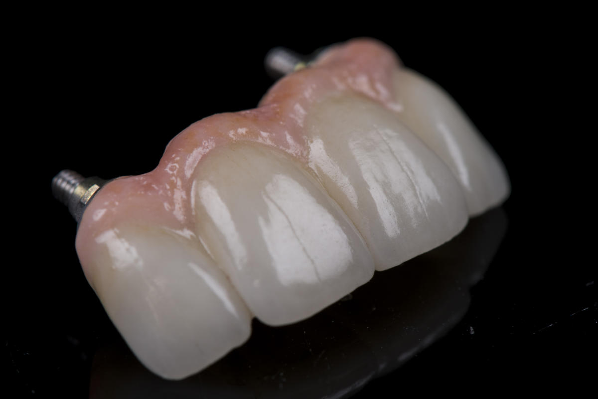 Pink Esthetics Kwalident Dental Studio